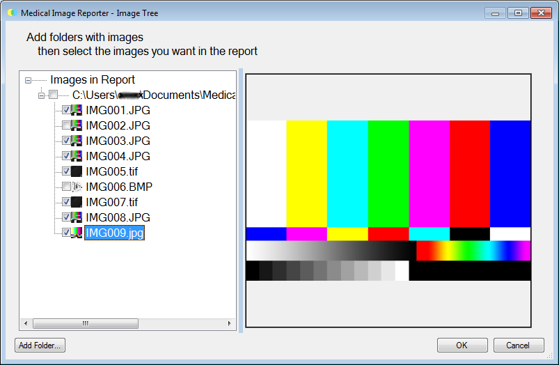 Setup Screen